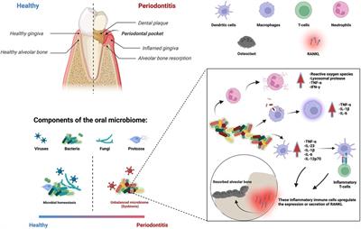 Innovative biomaterials for the treatment of periodontal disease